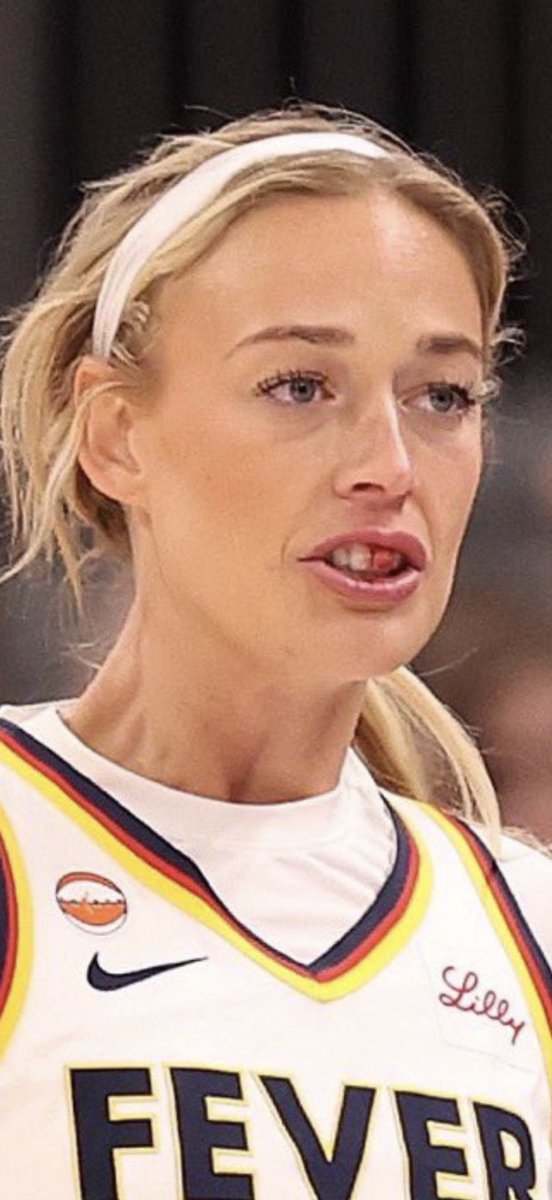 JohnAShmitty's tweet photo. @IndianaFever @EliLillyandCo Sophie Cunningham was attacked by DiJonai Carrington. Following the game, Steph White praised DiJonai. 

 “One of the things about Nai is that she’s gonna play her butt off, man. She’s gonna compete. Nobody’s gonna go walking in for a layup. And so, I don’t oppose the hard foul.” https://t.co/hgEGK2KVua
