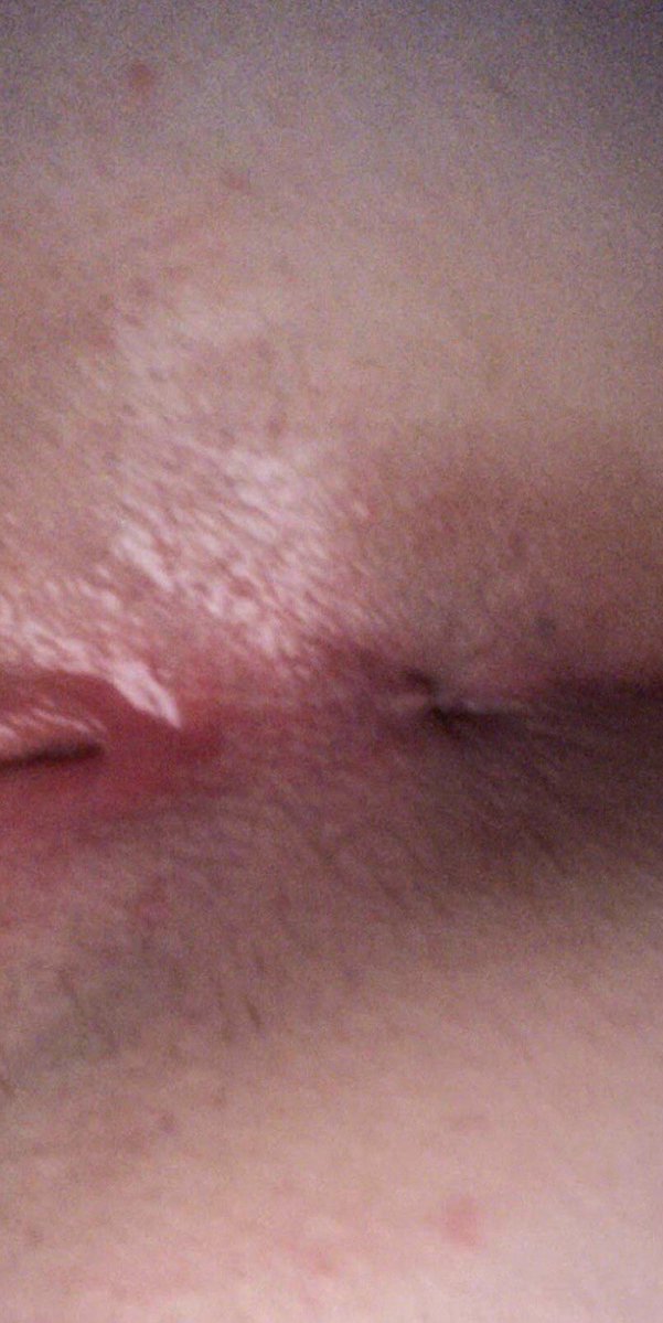 queenngapee's tweet photo. Look how fucking stinkyyyy and dirty my little butthole looks. I wish someone were here to sniff it #nsfwtwt #asshole #goonette #buttslut #yungho #teenasshole #masturbation #butthole #goon #butt #hole #analfingering #anal #teenholes #pornhub #pussyspread #pussy #teenpussy #horny https://t.co/eFInNK6DWY