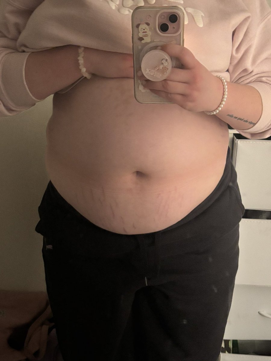 bunorexia's tweet photo. hi every bunny!! i’m rue:3
first pic is me in 2025 and second pic is yesterday!! i’ve lost ~30kg
but i can feel my progress slowing and need to lock back in!!
my gw is 59kg or less and my cw is 70

let’s be friends!!!:333

🏷 proana edtwt 3dtwt eedeetwt bodycheck bmi ricecaketwt https://t.co/WVOyjLYrwS