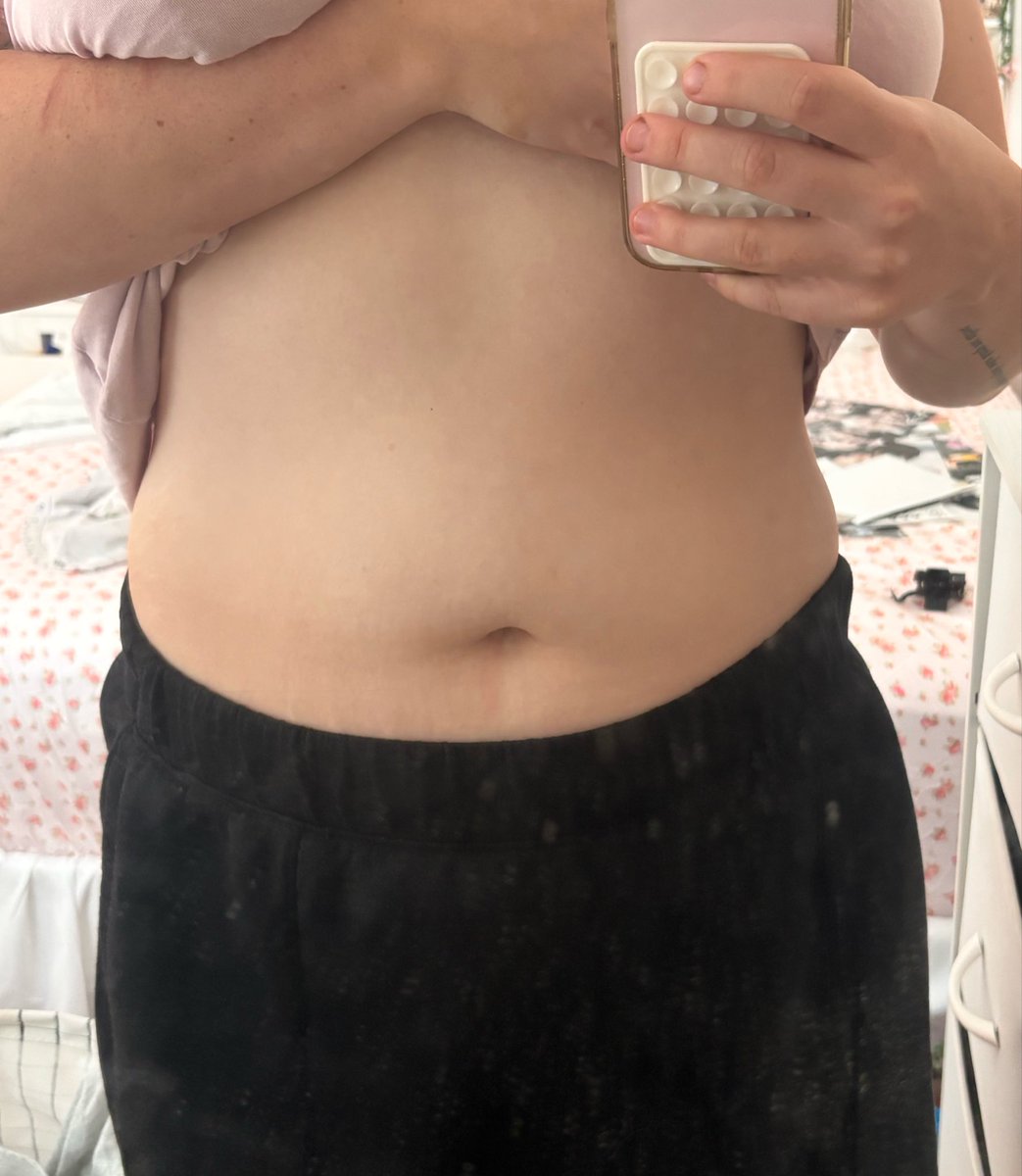 bunorexia's tweet photo. hi every bunny!! i’m rue:3
first pic is me in 2025 and second pic is yesterday!! i’ve lost ~30kg
but i can feel my progress slowing and need to lock back in!!
my gw is 59kg or less and my cw is 70

let’s be friends!!!:333

🏷 proana edtwt 3dtwt eedeetwt bodycheck bmi ricecaketwt https://t.co/WVOyjLYrwS