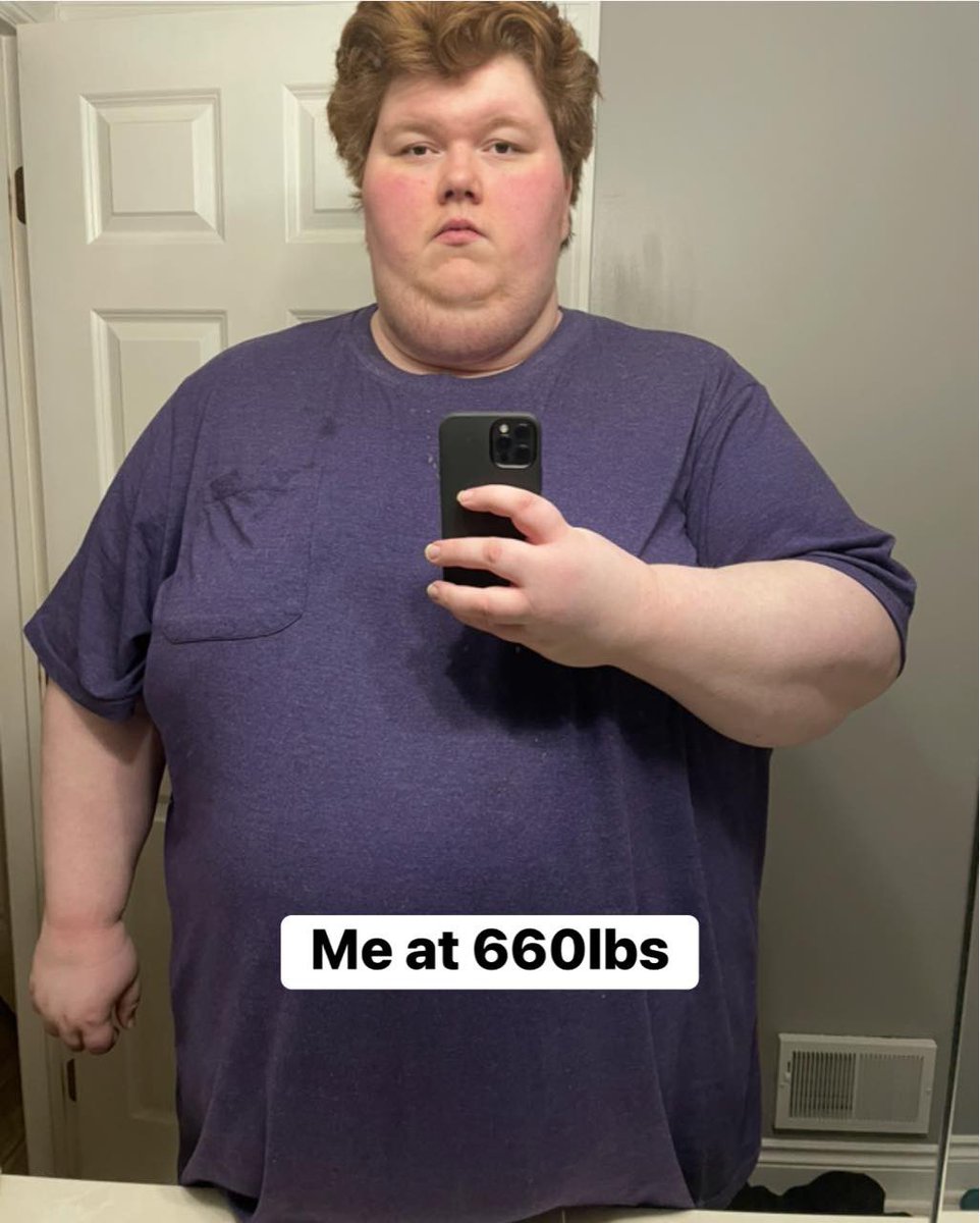 EthanBenard's tweet photo. Over 250lbs lost so far! 😁💪🏻

The journey from 500 to 400 has been the hardest thing I’ve ever endured. I’m super excited to hit that 399 mark, and I’m *extremely* nervous for the road from 400 to 300.

For now, I’m still fat, and I gotta keep going 💪🏻

#weightlossjourney https://t.co/Je7qxhKvgW