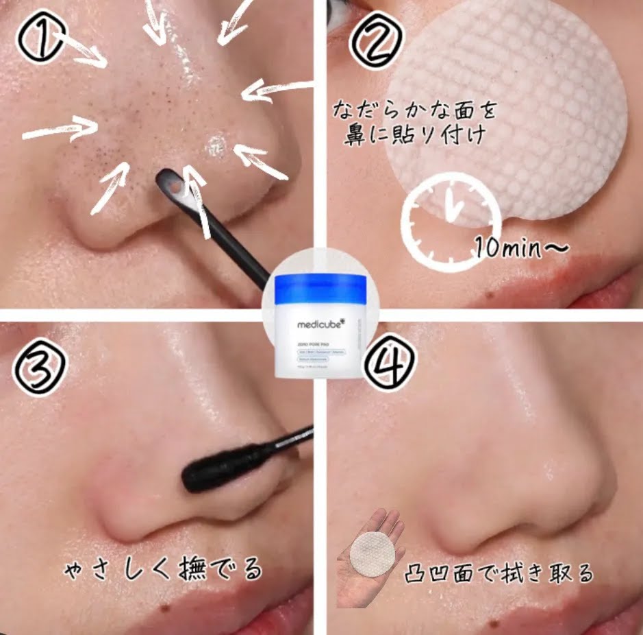 popin_cosme's tweet photo. 正直あんま教えたくないんやけど、ヤバい裏技見つけた。
←パッドにグリシルグリシン2、3滴垂らして
→これしたら、黒ずみ一掃。
正直、普通に使ってた時間全部無駄やったレベルですごい。 https://t.co/QWStdrsTu9