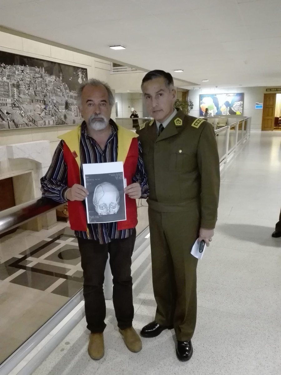 Miguel_a_Rendon's tweet photo. #ChileEnOrden
Tenemos que recuperar el respeto a la autoridad
Hhmmm..
A Nuestro Hijo casi lo matan/Homicidio Frustrado, los Comandos de las Autoridades @Orrego y su Delfín, la Subsecretaria de Prevención del Delito 
@CarolinaLeitao que violaban la Ley Electoral 
X eso #leyluciano https://t.co/2HTOHSexjB