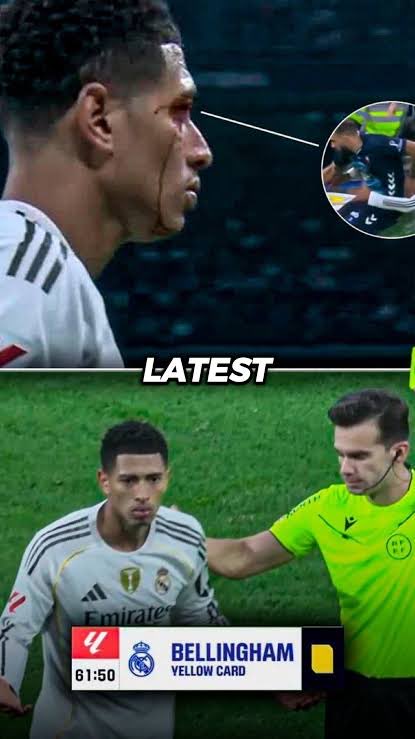 MadridSpot's tweet photo. Referee Quintero has now been promoted as an international referee, which means more salary and more bonuses. Systemic corruption continues.

What did he do?

He gave Jude a yellow after Jude was left bleeding from his eyebrow on the pitch and then entered the pitch early, while Borja Iglesias, who hit him, saw no card.

He sent off three Madrid players in the same match. Fran García got two yellows in a minute, Carreras was shown a red for dissent after supposedly saying, “You are terrible” to the referee, and Endrick was also sent off for dissent.

Remember, this is the same league where Raphinha calls the referee a “son of a whore” in almost every match Barca lose.

And even worse, immediately after the match, Barca propaganda pages pushed the opposite narrative that Quintero was going to get demoted because Mejía Dávila, Madrid’s referee delegate, happened to speak to the referee and for showing red cards to Madrid players. What happened is the opposite; he got promoted.

Propaganda, lies and deceit are the essence of this evil Negreira league.