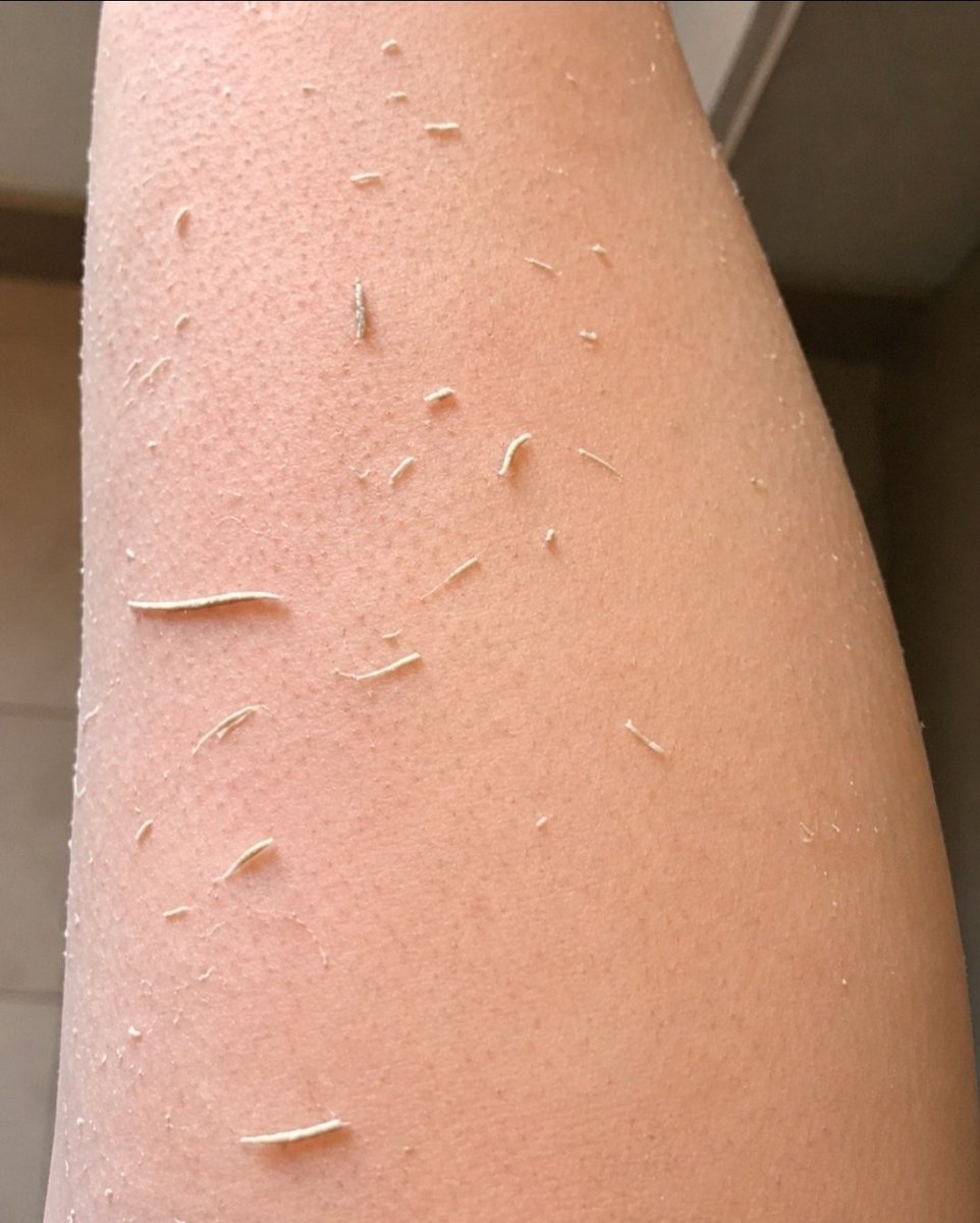 PatrikTheBatman's tweet photo. Hey @grok, after taking a shower, these tiny particles come off when I rub my skin. What are they? Should I be worried? 😳 https://t.co/4VJietMoaW