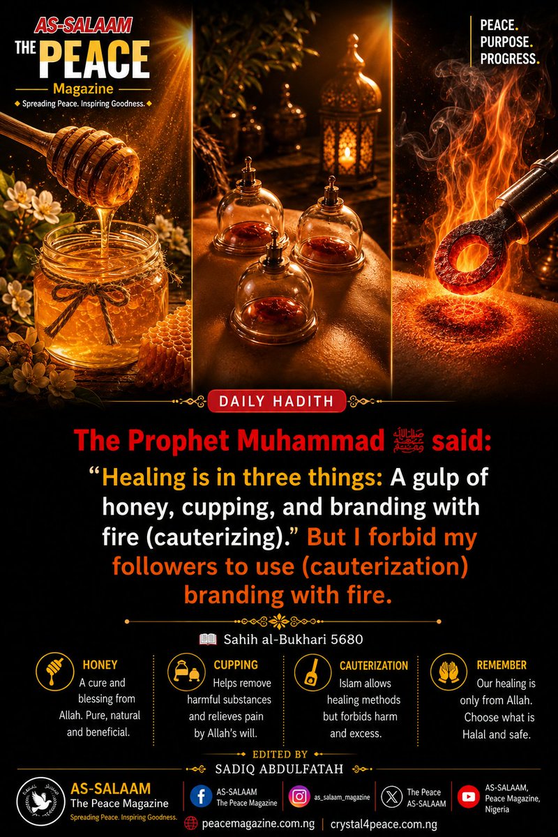 as_the13237's tweet photo. A beautiful reminder of the Prophetic guidance on seeking treatment while avoiding unnecessary harm. 

#DailyHadith #PropheticMedicine #Sunnah #IslamicReminder #ThePeaceMagazine https://t.co/j9pIJSMzu3