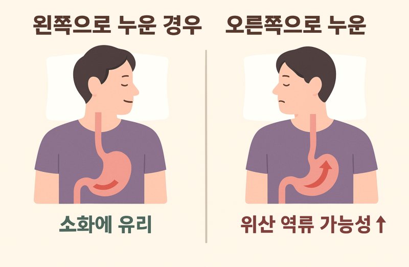 youtu_03's tweet photo. 혹시 밥먹은다음 혈스맞고 꿀잠자는게 취미인 트친들 있나? 이렇게 밥먹고 바로 자면 역류성식도염으로 고생하는데

왼쪽으로 돌아 누워서 자면 그나마 좀 괜찮다는 사실을 알았는데 넘 꿀팁이라 공유해봐요 https://t.co/3yB2QS51gj
