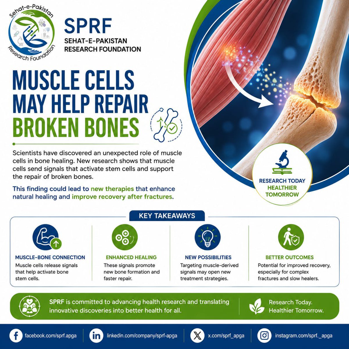 sprf_apga's tweet photo. 🦴💪 Muscle may help repair broken bones. New research explores its role in bone healing and future regenerative medicine. 💚 #SPRF #BoneHealing https://t.co/7miPOQhmgr
