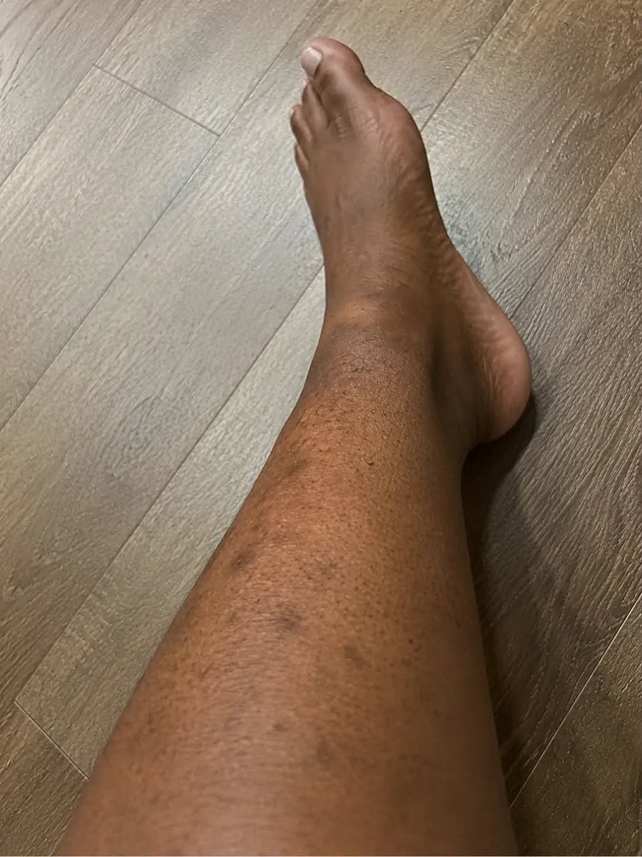 ladyhuneybee's tweet photo. Nothing makes me happy like investing on skin 🔥🔥🤌 as a woman https://t.co/vMfV5KVUig