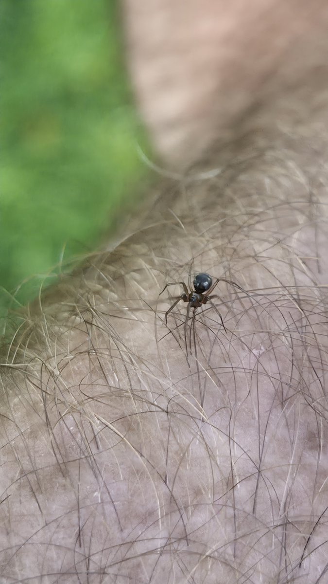 mylastsatoshi's tweet photo. The spider in the image is a male false black widow spider, specifically Steatoda grossa of the family Theridiidae.

This identification rests on the glossy spherical black abdomen, the contrasting brownish cephalothorax, the long slender legs, and the overall body proportions relative to the surrounding skin and hair.

No red hourglass is present on the visible surfaces, which immediately separates it from true widow spiders in the genus Latrodectus. 

While microscopic examination of genitalia would be required for absolute taxonomic certainty in every case, the external morphology aligns completely with mature male Steatoda grossa as documented across multiple reference collections and field guides.

Steatoda grossa follows a typical theridiid life cycle. Females deposit eggs inside spherical or slightly flattened white silken sacs that they guard within or near the web. 

Spiderlings emerge after several weeks, disperse by ballooning or walking, and pass through multiple instars before reaching maturity. 

Males mature more rapidly than females and become sexually active sooner. Once mature, males leave their natal webs to search for females.

These spiders construct irregular three-dimensional tangle webs, also called cobwebs or gumfoot webs. The structure consists of a loose scaffold of non-sticky threads with sticky capture lines that extend downward to the substrate.

When an insect contacts a sticky line, the tension pulls the prey upward into the main web where the spider immobilizes it by wrapping silk with the comb-like bristles on its fourth pair of legs. 

Webs are typically placed in sheltered, dimly lit locations such as cupboards, wall voids, under furniture, or outdoor crevices.

Courtship is cautious. A mature male approaches a female web and produces characteristic vibratory signals by plucking or drumming on the silk. These signals advertise his identity and reduce the chance of being treated as prey. 

Successful mating may still carry risk of cannibalism, though it is less frequent than in some true widow species. Females store sperm and can produce multiple egg sacs over successive months.

Brood size varies with female condition and climate. Each sac commonly contains several dozen eggs, and a single female may produce several sacs in a season, resulting in total reproductive output of well over one hundred offspring under favorable conditions.

Ecologically the species is beneficial. It preys on a wide range of small insects and other arthropods, including flies, cockroaches, ants, and occasionally other spiders.

By reducing populations of these organisms in and around human dwellings it provides natural pest control without chemical intervention. It has even been recorded preying on true black widows in shared habitats.

Adult females can live one to three years under protected conditions. Males typically live only a few months after reaching maturity, their primary remaining function being reproduction.

Additional notes of interest include the species cosmopolitan distribution, facilitated by human transport, and its mild venom. Bites are uncommon and produce localized pain comparable to a bee sting in most healthy people. The spiders are non-aggressive and prefer to retreat when disturbed.

#SpiderID #FalseWidow #Spider #Arachnology #NaturePhotography
@Arachno_Cosas @ISArachnology @drspidernz @Cataranea @spiderprofessor @ArachnoGal @AndiFischer10 @AAS_arachnology