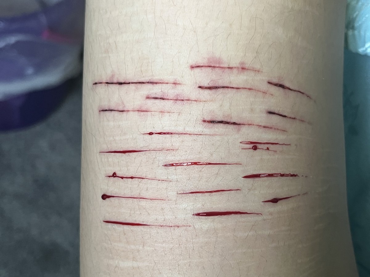 theavoidedsun's tweet photo. sfx ai generated

shtwt 988twt barcodetwt catscratchtwt ouchietwt raspberryfilling sliceytwt styrotwt https://t.co/RrNuklDOUE