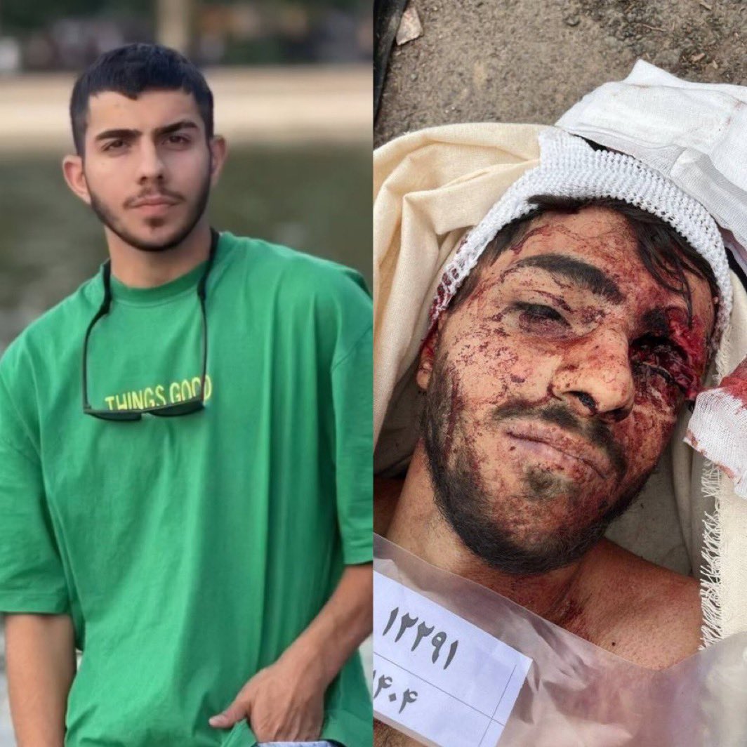 Rad_IN_'s tweet photo. مربوط به پست قبل ! 
#جاویدنام #محمد_امین_غلامی 
داداش دورت بگردم تو چقدر غریبی کلا تو X دوتا هشتک به اسم تو بود 😭 https://t.co/5F3UQMxNTC