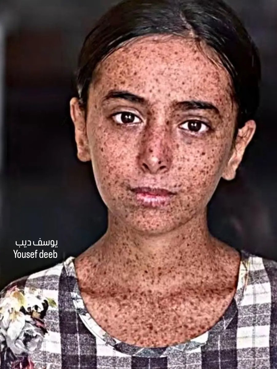 Timesofgaza's tweet photo. Mays Al-Qudra, a Gazan girl living with illness, as limited care takes a toll on her mental well-being and childhood. https://t.co/hrLEyDOMrU