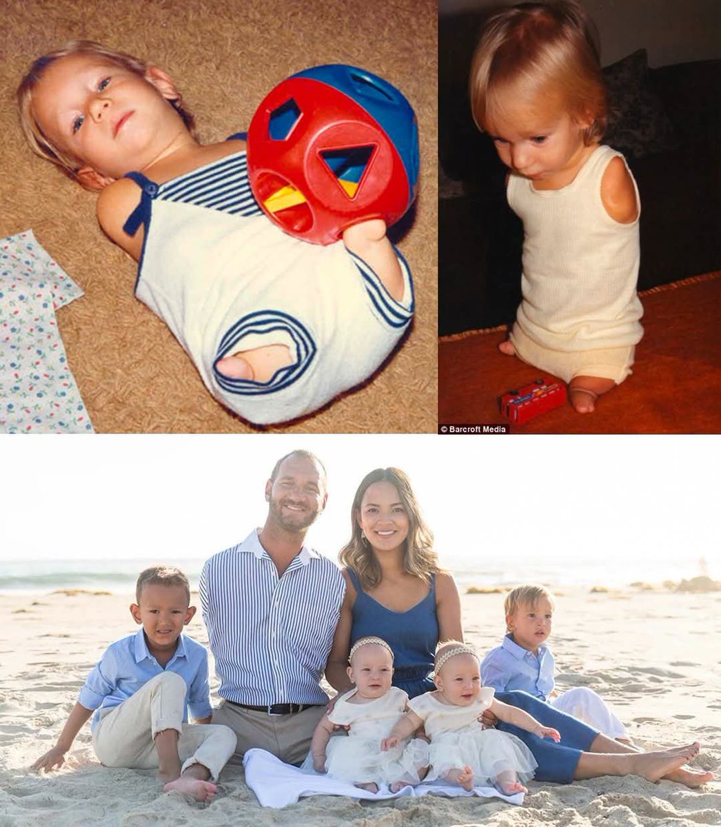 WolfofX's tweet photo. Nick Vujicic entered the world on December 4, 1982, in Melbourne, Australia, born with tetra-amelia syndrome, an extremely rare condition that left him without arms and legs. 

His parents were devastated at first, and Nick spent much of his childhood struggling to understand why he was different.

School was especially difficult. He endured years of bullying, isolation and depression, and at just 10 years old, he attempted to take his own life. 

What stopped him was the thought of the pain his parents would suffer if he was gone.

Over time, Nick learned to adapt and become remarkably independent. He taught himself to write, type, use a computer, brush his teeth, shave, answer the phone, swim, surf, fish and even play sports using his small left foot, which has two toes. 

He later graduated from university with a Bachelor of Commerce degree, majoring in Accounting and Financial Planning.

At 17, Nick began speaking publicly about faith, hope and resilience. What started as talks to small groups eventually turned into a global mission. 

Through his organization, Life Without Limbs, he has shared his message with millions of people in schools, prisons, stadiums, churches and conferences in more than 70 countries, encouraging countless individuals facing hardship, disability, bullying and mental health struggles.

Nick married Kanae Miyahara in 2012, and together they have built a family with four children. He has also authored several books, including Life Without Limits, and continues to travel the world proving that limitations do not have to define a person's future.

From a boy who once believed his life had no purpose to a husband, father, author and internationally recognized speaker, Nick Vujicic's journey remains one of the most inspiring examples of perseverance, faith and the power of choosing hope despite overwhelming odds.