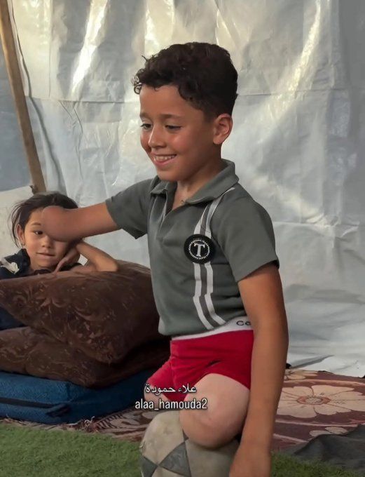 MyPalestine0's tweet photo. هذه هي المأساة التي يعيشها أطفال غزة .

أطرافٌ فُقدت، لكن العالم لا يجب أن يفقد إنسانيته .

لعن الله الاحتلال بعدد أنفاس البشر . https://t.co/h1sujtys8C