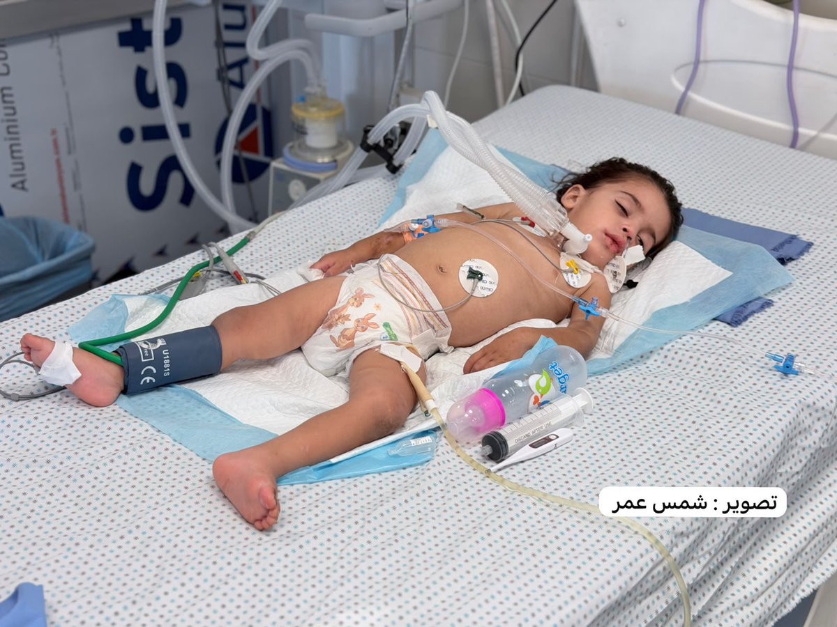 Tragedy in Gaza: Baby Waleed al Ghoola's Fight for Survival Amidst Ongoing Aggression