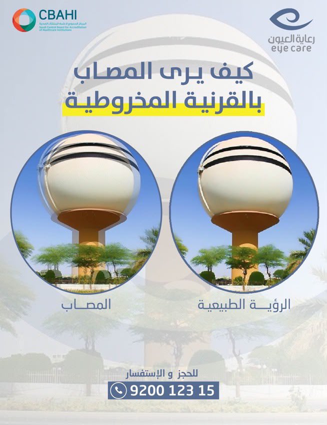 eye_care1's tweet photo. كيف يرى المصاب 
بالقرنية المخروطية :

خدمات مركز رعاية العيون التخصصي :
- إزالة الماء الأبيض
- عملية تصحيح النظر
- تجميل العيون
- علاج وجراحة الشبكية
- امراض العيون والحول
- جراحات القرنية
- العدسات اللاصقة

بريدة - طريق علي بن أبي طالب - مقابل الاستاد الرياضي.
للاستفسارات 
 920012315
