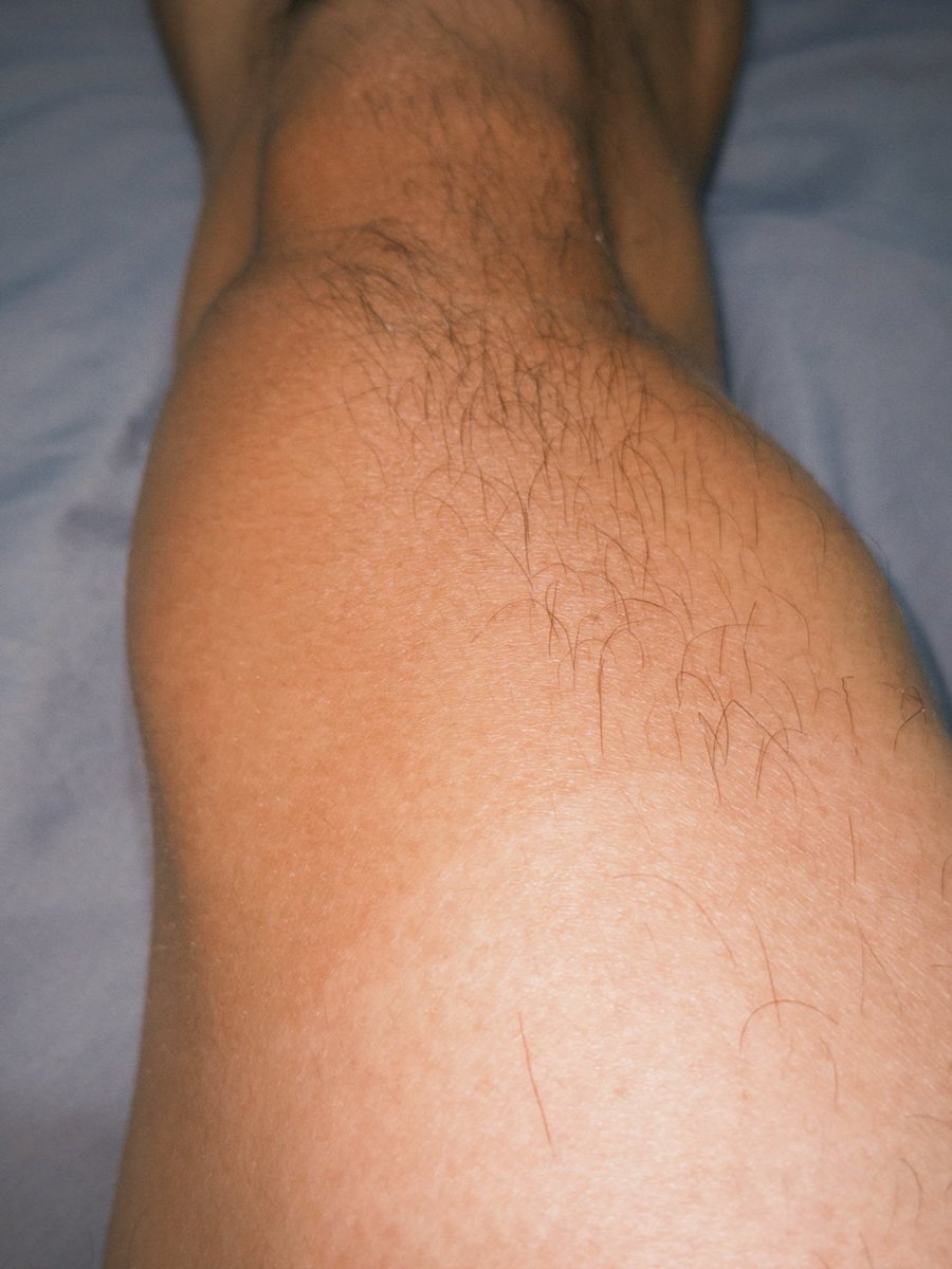 Anck3309's tweet photo. 曬出色差的腿🥵 https://t.co/PaoTtMlbgO