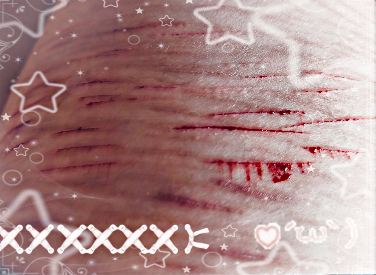 scr3amingf1sh's tweet photo. some cat scratches ! /⁠ᐠ⁠｡⁠ꞈ⁠｡⁠ᐟ⁠\ 

SFX makeup!! not real!! makeup for halloween!! 

#sh #cutspo #scarspo https://t.co/j8fR3I8dnV