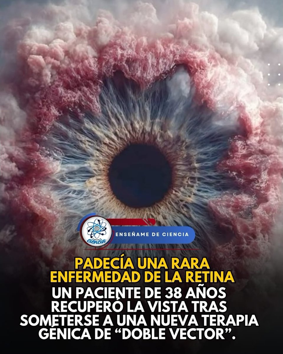 EnsedeCiencia's tweet photo. En Italia, un hombre de 38 años se convirtió en el primer paciente del mundo en recuperar la vista al someterse a una nueva terapia génica de “doble vector”. El paciente padecía una rara enfermedad de la retina, pero la terapia génica resultó ser altamente efectiva para corregirla.