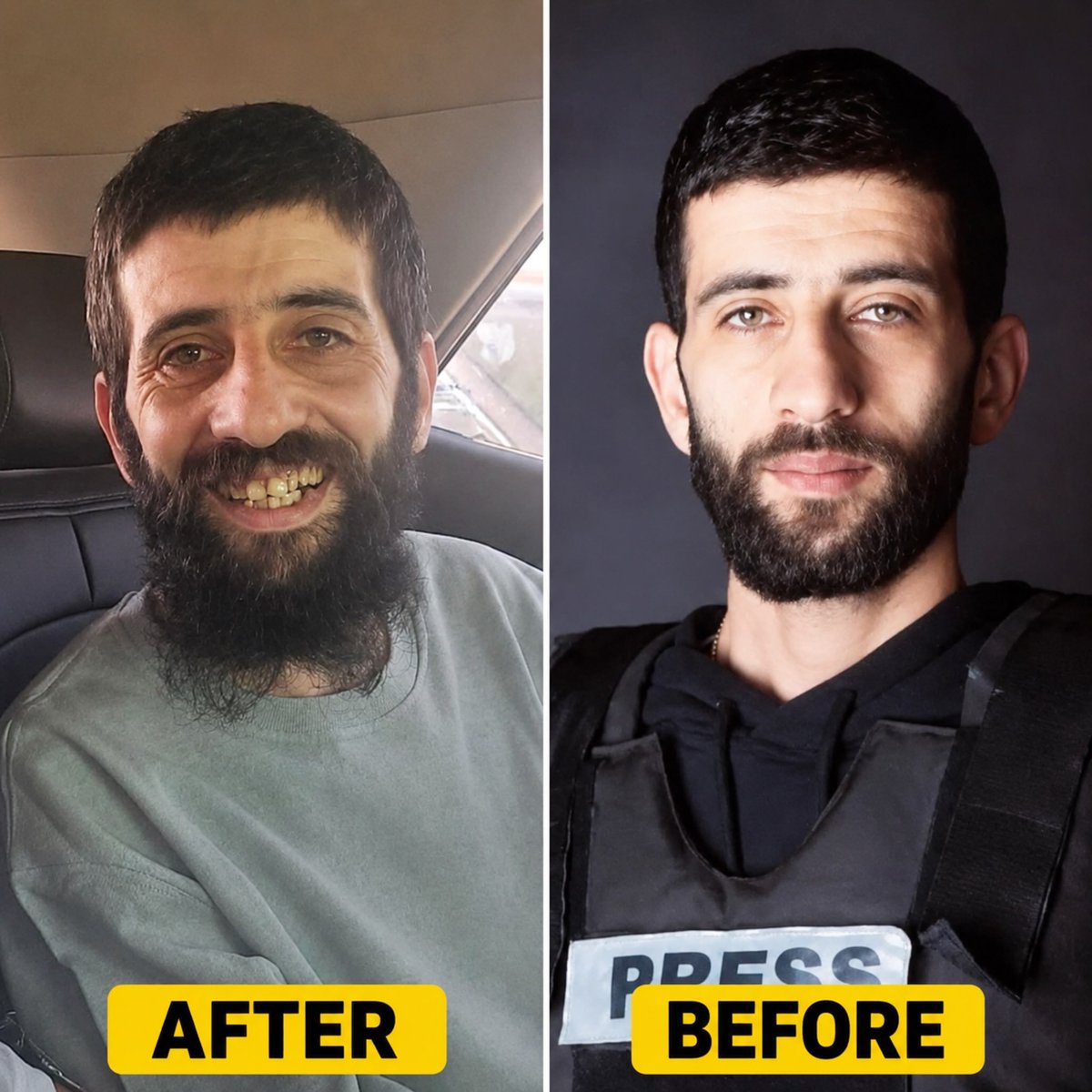bayrakmedya's tweet photo. İsrail tarafından yaklaşık 2 yıl boyunca tutuklu tutulan Filistinli gazeteci ve fotoğrafçı Ramez Awad’ın serbest bırakıldıktan sonraki son hali: https://t.co/wijeExNYno