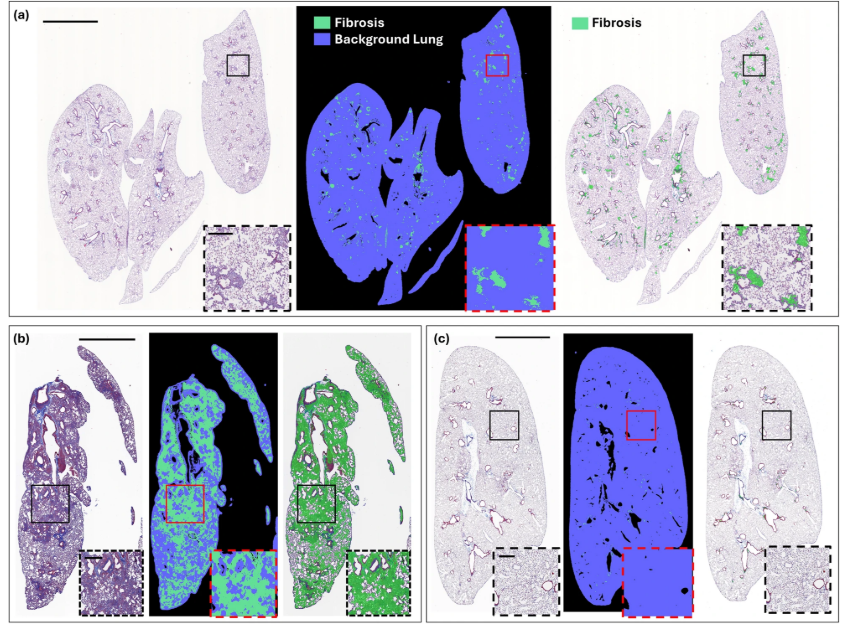 RespiratoryBMC's tweet photo. 📕 Article Alert 📕

Artificial intelligence, machine learning-based automated fibrosis quantification in preclinical models of pulmonary fibrosis
#OpenAccess #AI #RespiratoryResearch

Read the article: https://t.co/2IVZzL6Kak https://t.co/O6P6sZGivS