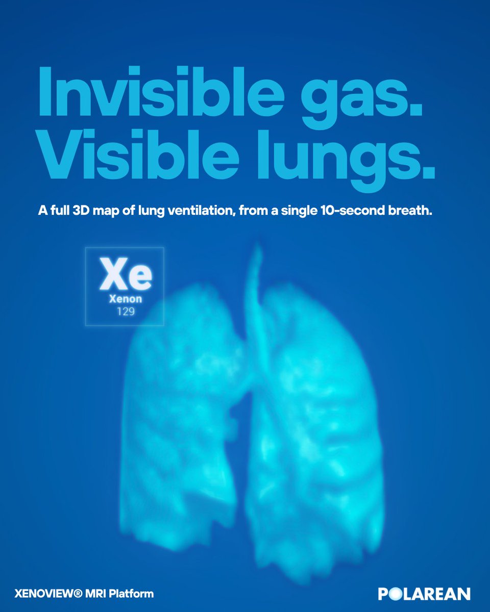 PolareanImaging's tweet photo. Xenon gas is basically invisible to a standard MRI.

So how does the XENOVIEW® MRI Platform turn a single 10-second breath into a full 3D map of lung ventilation?

Short answer: we boost that gas's signal by 10,000-fold — through hyperpolarization — before the patient ever inhales it. 

Full Indication & Important Safety Information: link in bio.

#XenonMRI #Hyperpolarization #FunctionalLungImaging