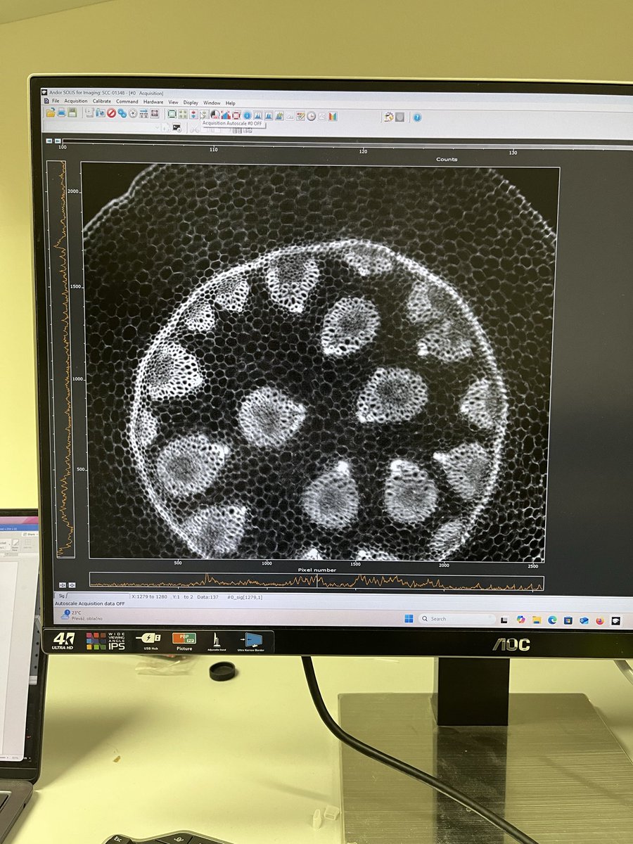 InnovativeBioi1's tweet photo. Testing our new ultrafast confocal microscope… Not bad!🤔 In fact, pretty amazing!😎😊 https://t.co/8nPiL6hZTn
