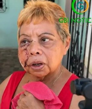 torito_01's tweet photo. Caso  #Bojorquez 
  mirando  las  imágenes TU   a  quien le crees ?? 
al "Osito"  
O  a la  ruca  que  lo  golpeaba ??
#NarcoPartido
Zumpango https://t.co/uwVKkDqUTl