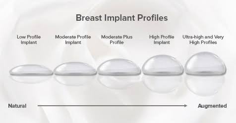TheCosmeticLane's tweet photo. If you’re doing implants, would you want high profile, moderate or low profile?
over or under the muscle?
Would love to use this thread for who are interested in getting it done & those who’ve done them to share their experience 🫶🏽 #community #talkback https://t.co/bf1oJXXe9j