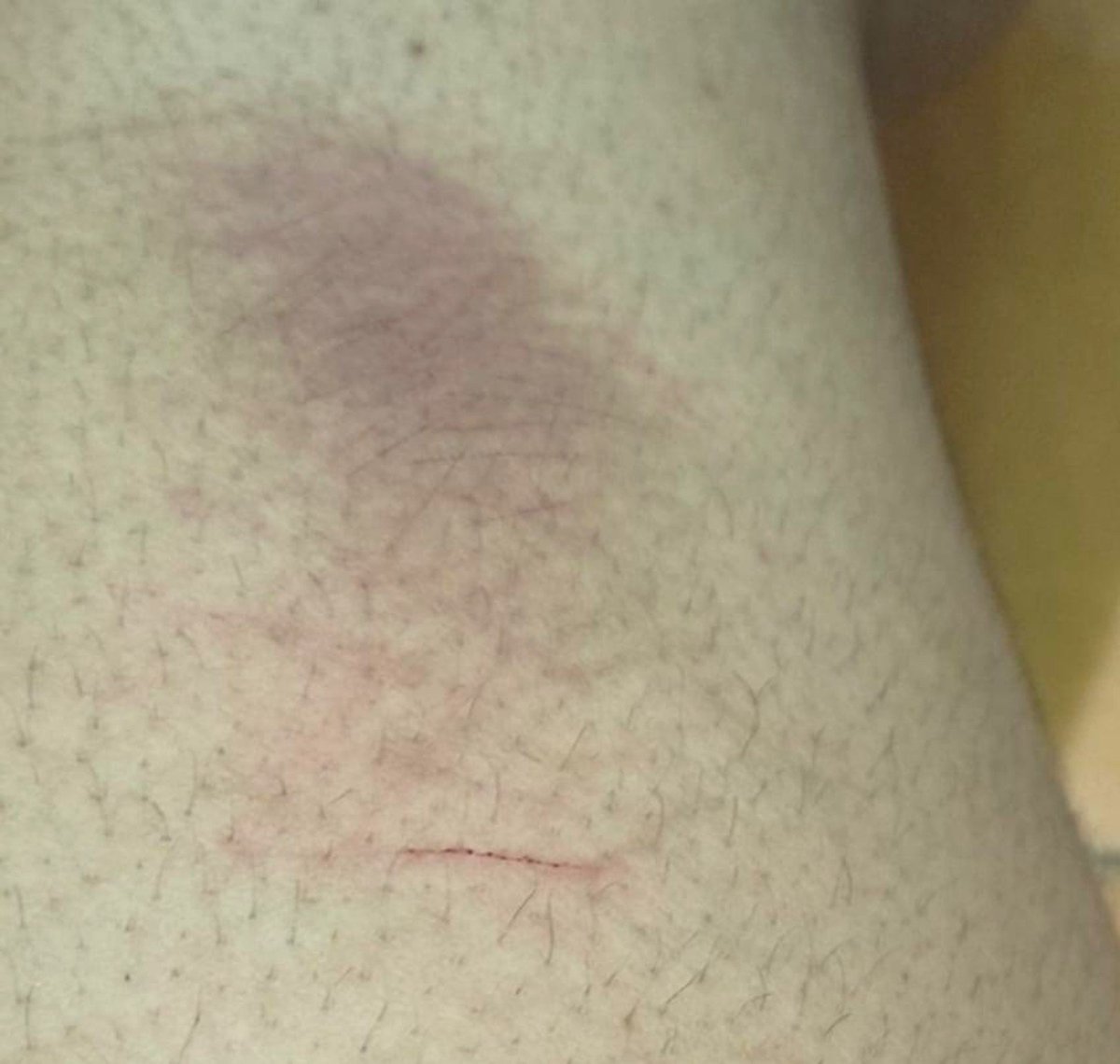 sorebodied's tweet photo. Healing cuts https://t.co/SpEtZlQYPo