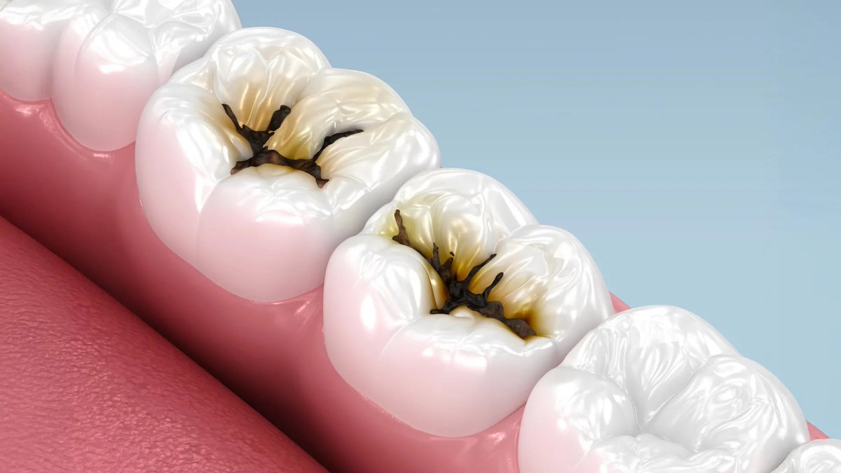 COVID19_disease's tweet photo. 🚨 BREAKTHROUGH: A molecule in broccoli &amp; cabbage just killed 90% of cavity-causing bacteria in lab studies.

And no, it’s not fluoride.

Here’s how this changes everything about dental care.🧵 https://t.co/WrEAO0bPTx