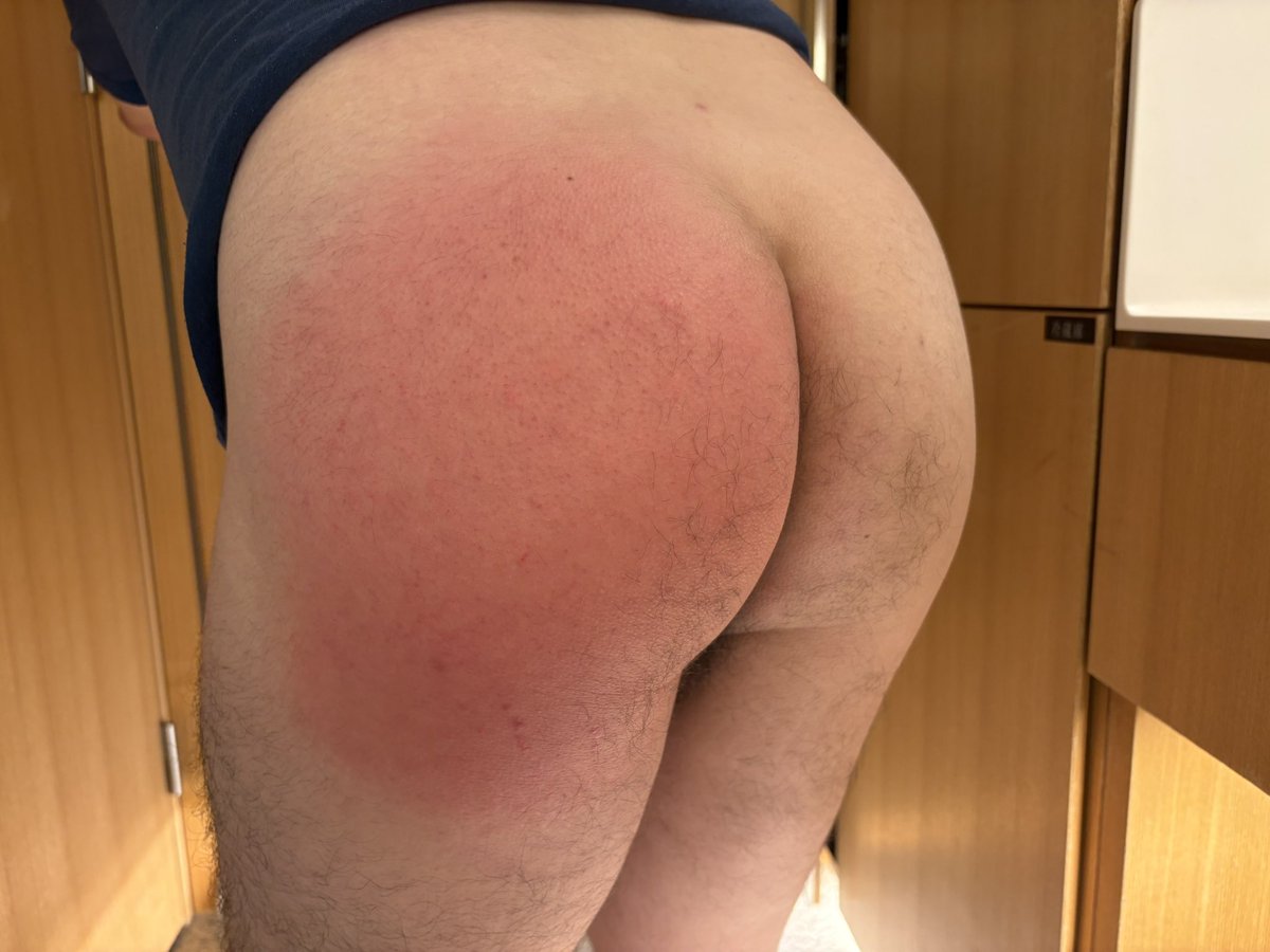 QLFDffNKPf86918's tweet photo. お盆のお仕置き
お尻にとっても熱い夏となりまひた🍑 https://t.co/jgqnRzynxW