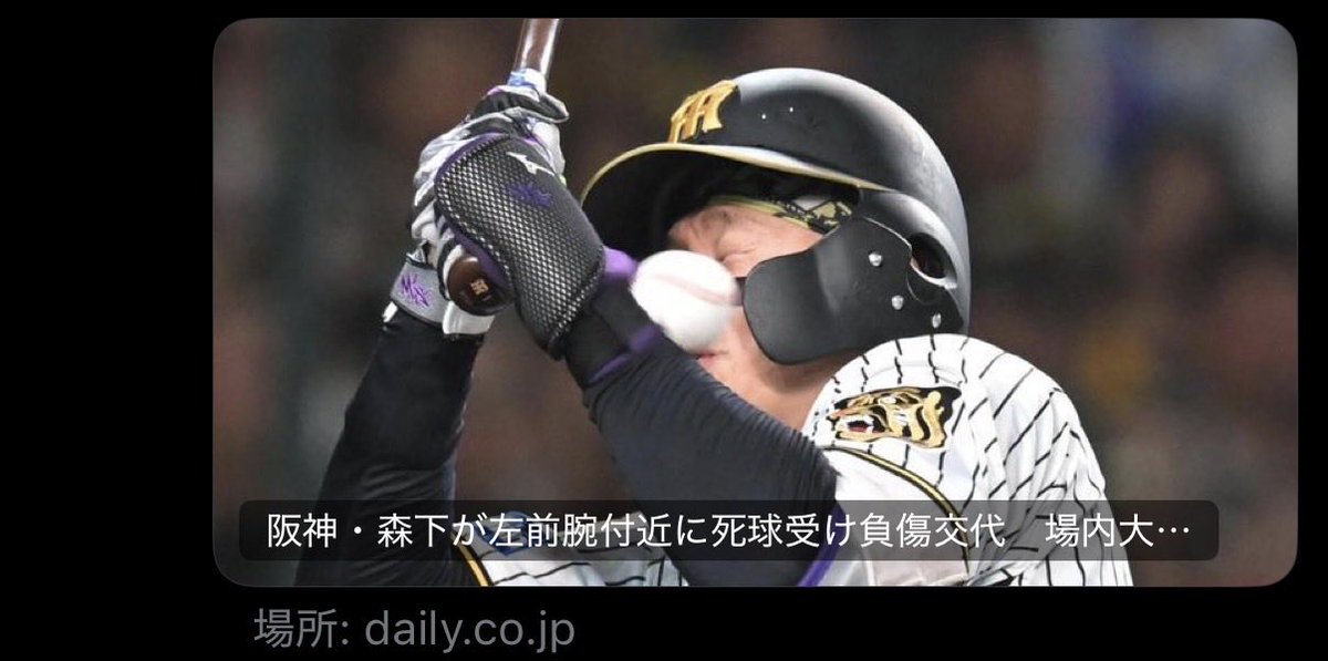 sweet_tweet_C's tweet photo. 何も知らずにこれだけみた。顔に当たったんかと思った😱😱😱手首でも辛いよね。 https://t.co/xddKgfqLd1