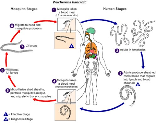 lefilsdaffou's tweet photo. FILARIOSE LYMPHATIQUE 🪱🦟

Communément appelé ÉLÉPHANTIASIS La filariose lymphatique est une maladie parasitaire principalement due à Wuchereria bancrofti. 

Transmission : Piqûre de moustiques 🦟 infectés.

Les larves migrent ensuite vers le système lymphatique, où les vers adultes peuvent perturber progressivement la circulation de la lymphe.

🩺La maladie peut provoquer :

Fièvre et crises de lymphangite ;
Gonflement des membres ;
Douleurs ou augmentation du volume des ganglions ;
Œdème du scrotum et hydrocèle chez l’homme ;
Éléphantiasis dans les formes chroniques

Certaines personnes restent longtemps asymptomatiques tout en étant infectées.

🛡️ Prévention
L’utilisation de moustiquaires imprégnées
La lutte contre les moustiques 
Le dépistage 
Les campagnes de traitement de masse dans les zones endémiques.

💊 Le traitement :
L’ivermectine,
L’Albendazole
diéthylcarbamazine (DEC)

La filariose lymphatique fait partie des maladies tropicales négligées et peut entraîner un handicap important lorsqu’elle évolue vers l’éléphantiasis.