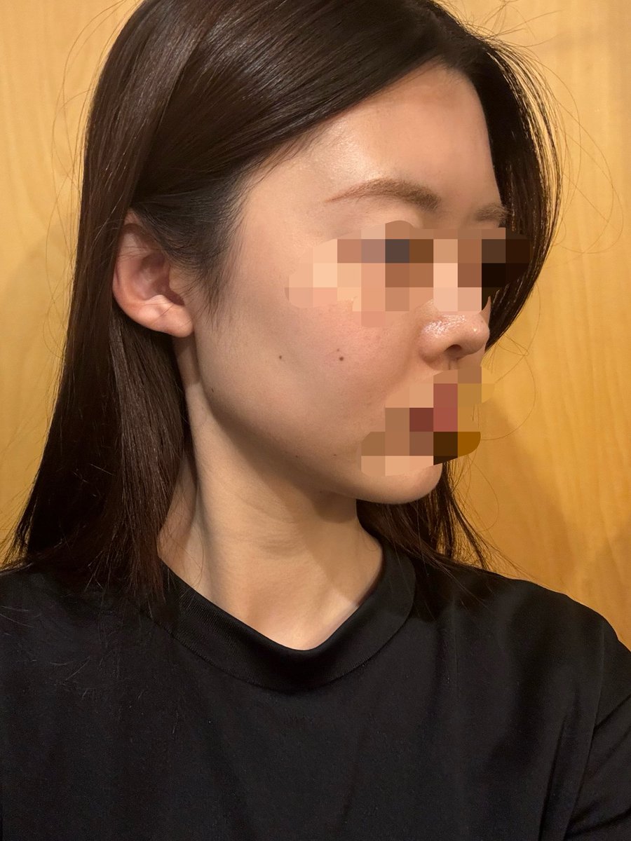 stayyactive's tweet photo. 7ヶ月です！かなり馴染みました😊 https://t.co/CFGxiuChJP