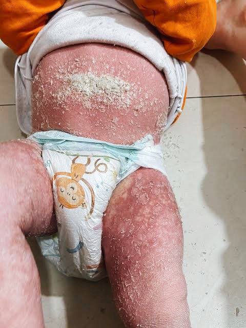 yousefQasem1998's tweet photo. I NEED TREATMENT😭

︎
︎

︎

︎

︎
︎

︎

︎

︎

we’ll remind you 🥺
︎

︎

︎

︎

︎
︎

︎

︎

︎

︎
︎

︎
︎

︎
︎

︎

︎

︎

︎
︎

︎

︎

︎

that
︎

︎

︎

︎

︎

︎
︎

︎
︎
💔
︎

My child has scabies, please help me. $100

https://t.co/45Gj0rpJam https://t.co/sPWgilV9nu