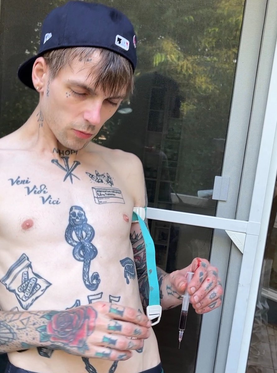 kaiba755's tweet photo. Left: heroin, fentanyl and cocaine addict, shooting every day, living on the streets.

Right: 769 days sober, learning to live a life I finally love.

My dad got me off the streets on July 21, 2024. I walked into detox at 49kg (108 lbs). Skin and bones, nothing else left. For more than half my life, I hated myself. I watched other people love being alive and couldn’t understand it. I was only ever surviving. Heroin and crack took everything, and I ended up on the streets as the exact person I swore I’d never become. Then fentanyl arrived and dying became normal. Friends took their last breath right in front of me. I od’d more times than I can count, woke up to Narcan again and again, always asking the same question: why am I still here? I tried quitting so many times. Detox, rehab, repeat. I always went back, because real change terrified me more than dying did.

Until one day I called my dad, crying. He came. Detox, then 18 months of long-term treatment. New state, new life, every old tie cut. Zero. Today I’m at peace. I love myself, the healthy way. I used to numb everything just to get through a day. Now I feel it all, the highs and the lows, and that’s exactly where the growth is. Of course I still have dark days. But it gets better, and I learned to deal with them instead of running. In the past, the smallest craving or wave of depression sent me straight back to using. Today I sit with it. I let it pass through me. And every time it does, I come out stronger than ever.

To my doctor, my therapists, and my parents: I owe you everything. 
If I came back from that place, so can you. Keep going. There’s light on the other side. We do recover.