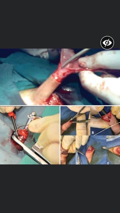 18uscsection116's tweet photo. @bethanyshondark @SethAMandel @AbdulElSayed @JesseBWatters @BloodstainedMen https://t.co/1tcuZ3CYXn