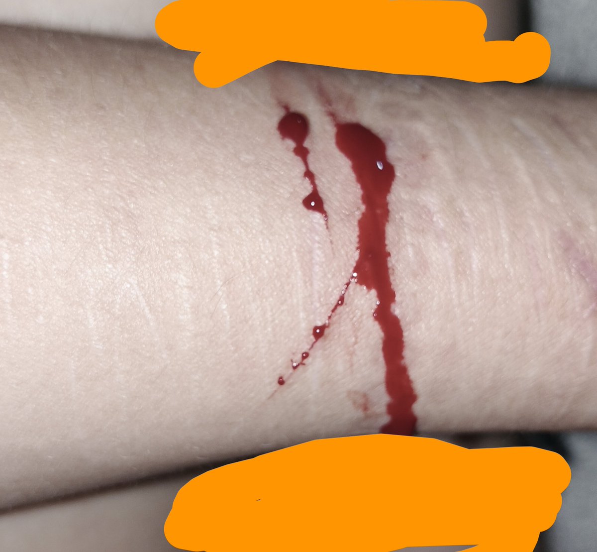 Emil_xt2's tweet photo. 5mil pasadas paraeftamrd૮(˶╥︿╥)ა —ALL FAKE SFX MAKEUP https://t.co/Up7yXbHaNT