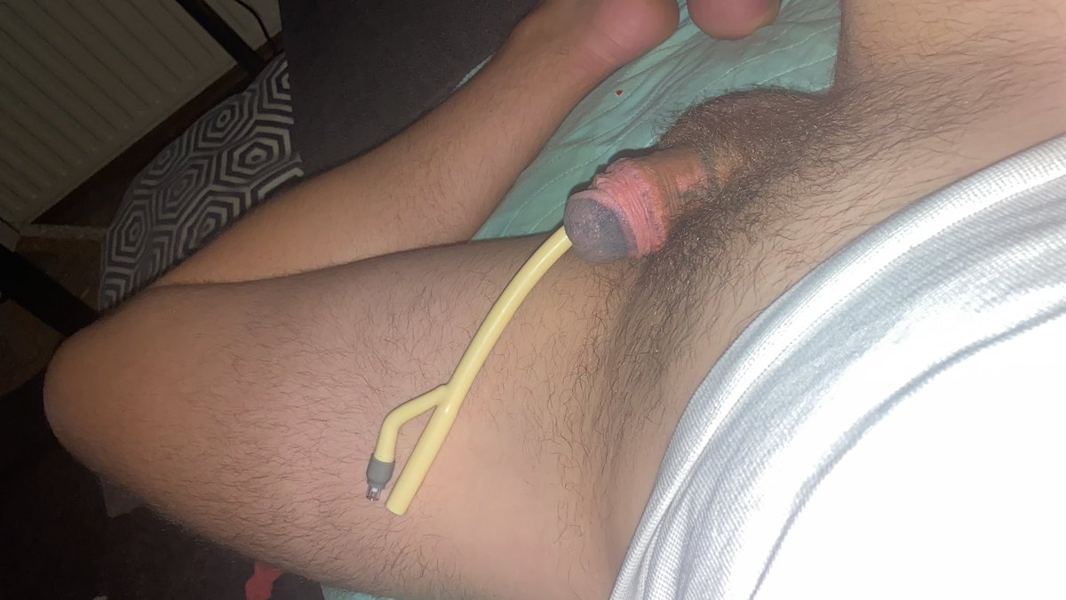 SplitCutCock's tweet photo. I’m pissing myself after removing my CH30 Foley catheter. #catheter #exposed #incontinent https://t.co/uWn16mmmtF