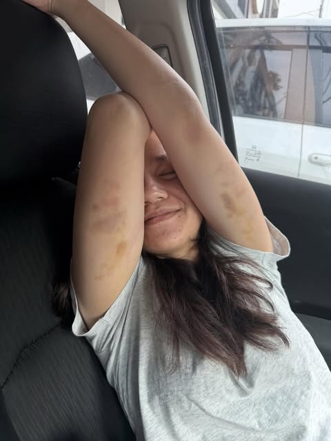 TomokoMullany's tweet photo. anakku diare, berobat ke DSA, liat obatnya ada interlac harganya 580, gue liat di online 380 wkwk:(( mayan 200rb beli dimsum mentai harusnya udah mabok tuh:( https://t.co/GP9hrxKOCa