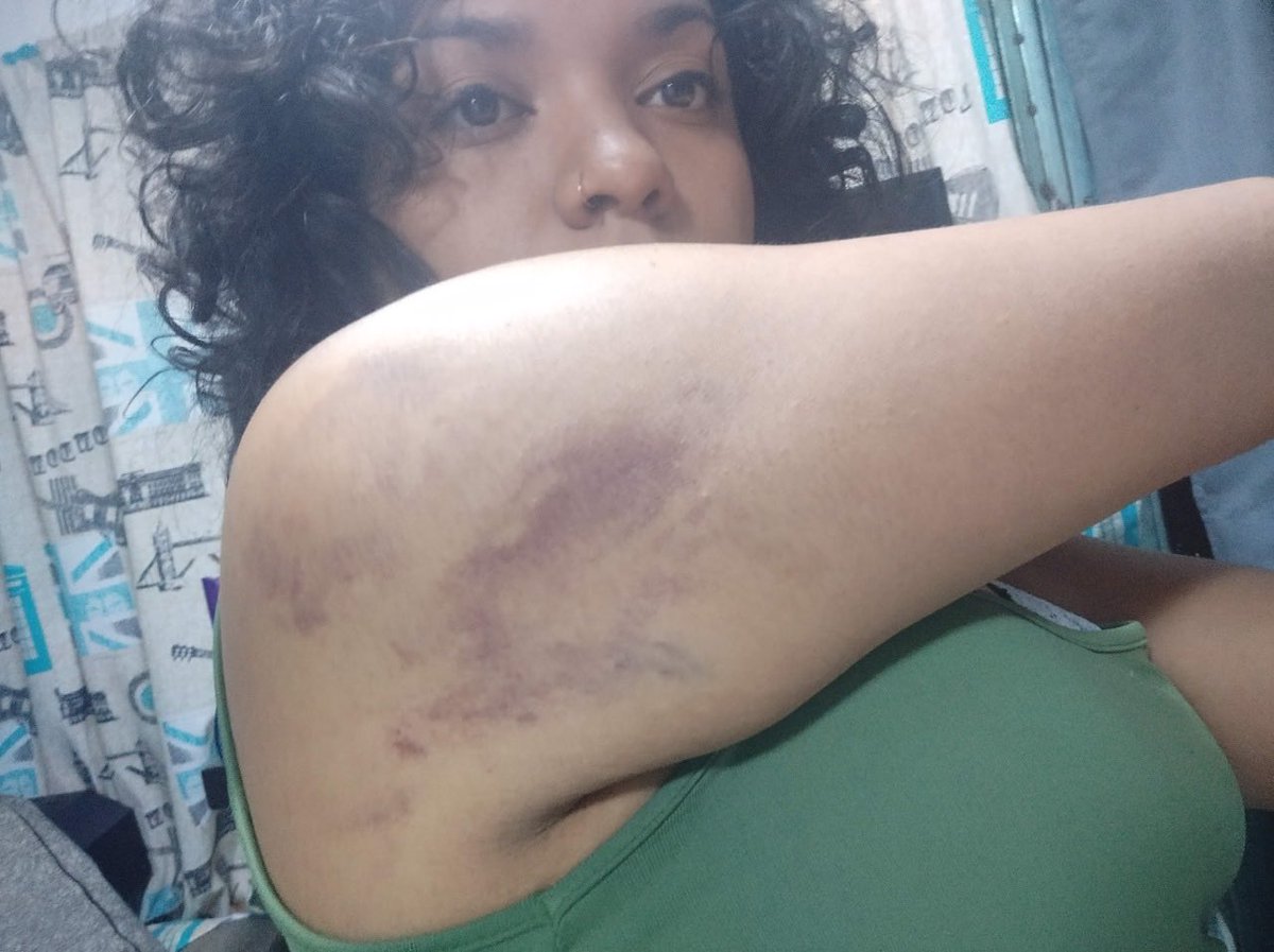 KeiityGonzalez's tweet photo. Lo más difícil en mi carrera, fue haber guardado silencio por miedo, ante el abuso que se ejerció hacia mi persona.  Por miedo a perder mi trabajo. Contarles a unos cuantos, hicieron que todo se convirtiera en un chisme. Pero bueno. Hubo testigos de esto. 

#yanoquierocallarme https://t.co/I560UGJMNb