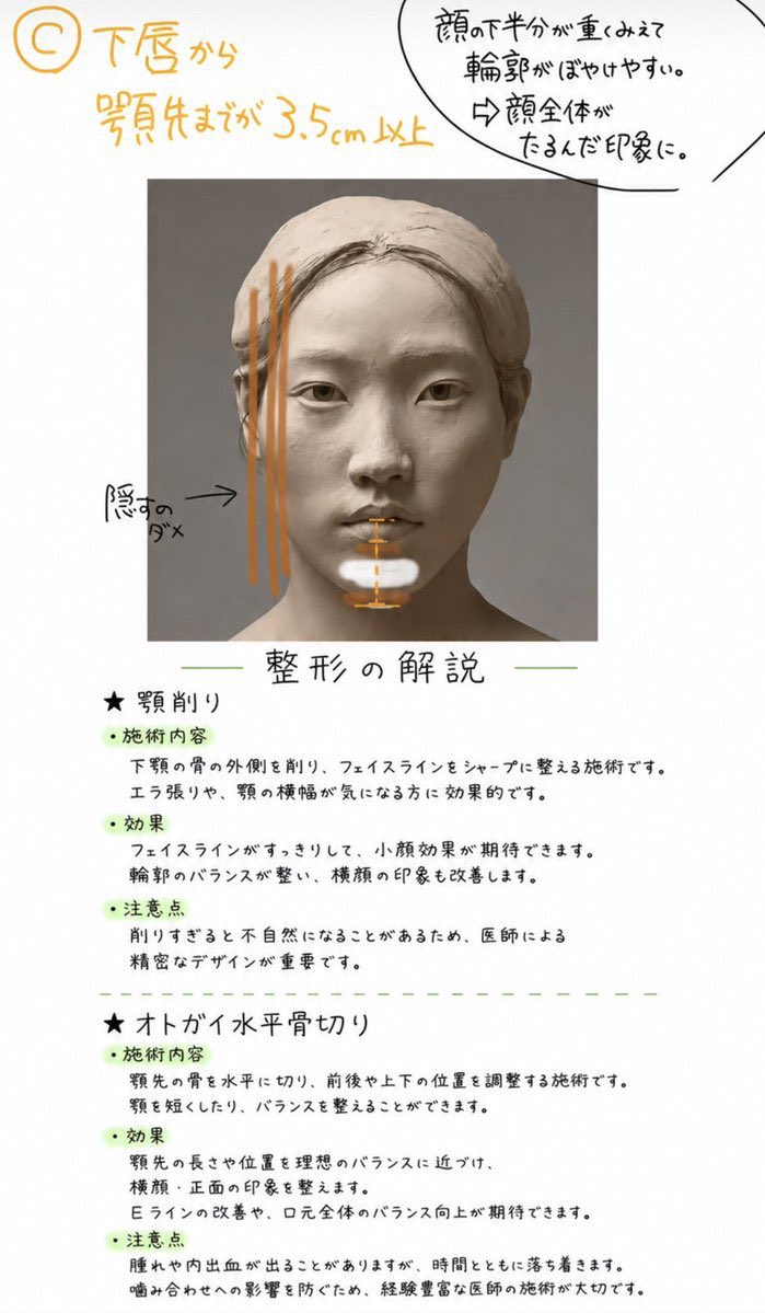 mtgjdpa's tweet photo. 面長整形の難易度Tier

A型面長（簡単）
額植毛や額縮小（前額リフト）があるので最も治しやすい

B型面長（激ムズ）
正直言ってポテンシャルゲー。物理的にはルフォーで数ミリ中顔面短縮させるか、中顔面たるまない様に裏ハムラ＋ミッドフェイスリフト位しかない

C型面長（個人差大）
オトガイ神経次第で顎先短くできる