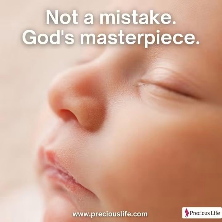 PreciousLifeCom's tweet photo. Not a mistake. God's masterpiece.

#SundaysForLife #PraytoEndAbortion https://t.co/wqYKiB70AE