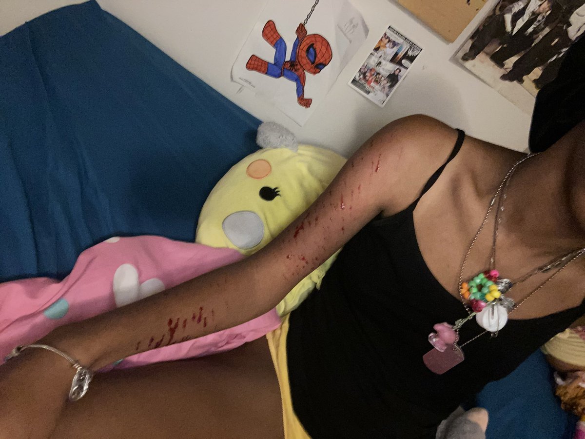 heyhowsitgoing's tweet photo. lil relapse after a few months ALL FAKE SFX MAKEUP #shtwt #depressiontwt https://t.co/TlY0vYKn4c