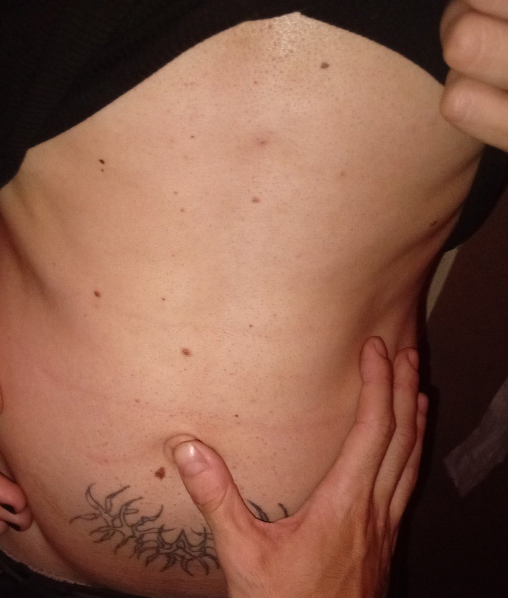 gilkalupis's tweet photo. Party archive 
#abs #abdomen  #bellybutton #ombligo #umbigo #gay #tattoo #outie #outiebellybutton #ombligoparaafuera https://t.co/sqqwVyEYwJ
