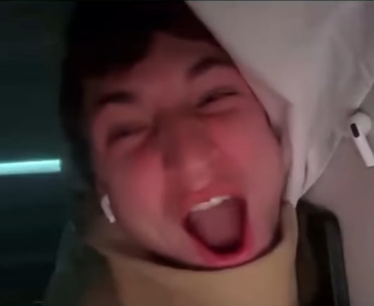 zombinada's tweet photo. he looks like a little bug when he does these faces #bof https://t.co/2W2NeGlB4J