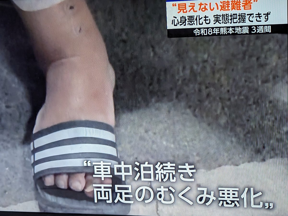 kojiskojis's tweet photo. 驚いた。8月18日21時のNHK。熊本地震で高齢者が3週間経った今なお、避難所の人目を気にして1人で車中泊。エアコンのガソリン代が1日3000円で、両足のむくみも悪化。避難所のプライバシーが確保されれば足を伸ばせるはず。関連死を防ぐため、”見えない避難者”支援が急務。行政による殺人を繰り返すな。 https://t.co/kInupYb6Ip