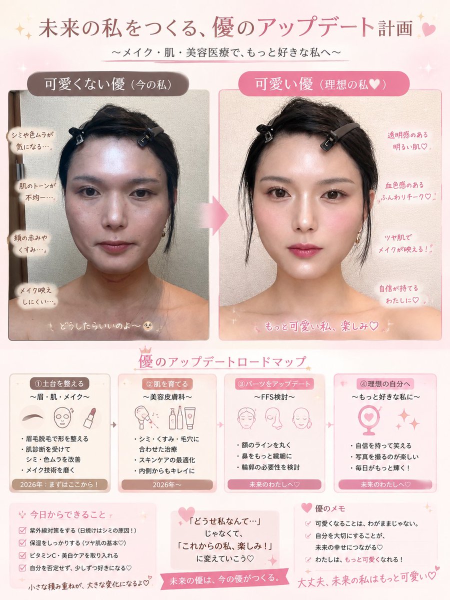 yuchanneljp's tweet photo. 顔ガチャ、ハズレだと思ってる私🥺
丸くないおでこ、鼻や輪郭、肌もまだまだ気になるところばかり。

でもこのまま嫌って終わるのはやめる🌸
美容皮膚科やメイク、将来はFFSも含めて、少しずつ「好きな私」にアップデートしていく🩷

これは未来の私の完成予想図🥺💕 https://t.co/E0Mv0fdWay